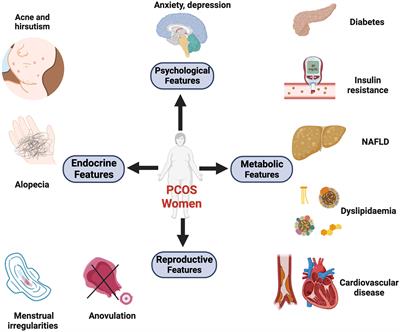 Androgen excess: a hallmark of polycystic ovary syndrome
